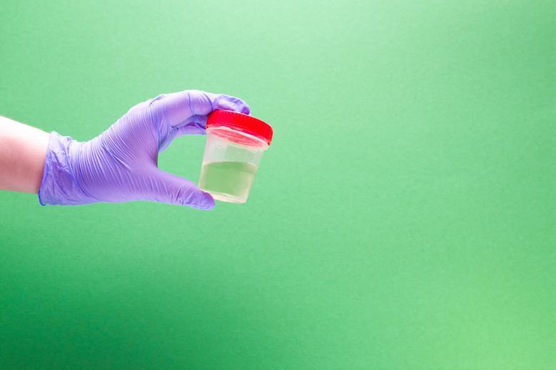 hand in a disposable medical glove holds a jar for analysis with urine, green background, copy space By Natasha